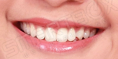 dummy_smile2_after