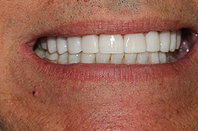 Image for Smile/Patient Name (Optional)