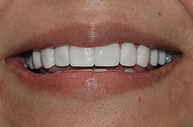 Image for 