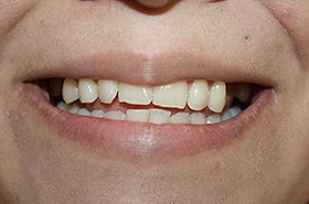 Image for 