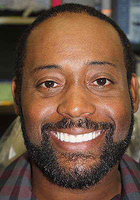 Image for Smile/Patient Name (Optional)