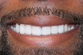 Image for Smile/Patient Name (Optional)