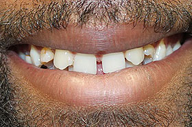 Image for Smile/Patient Name (Optional)