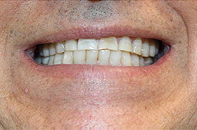 Image for Smile/Patient Name (Optional)