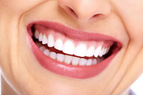 Image for Smile/Patient Name (Optional)